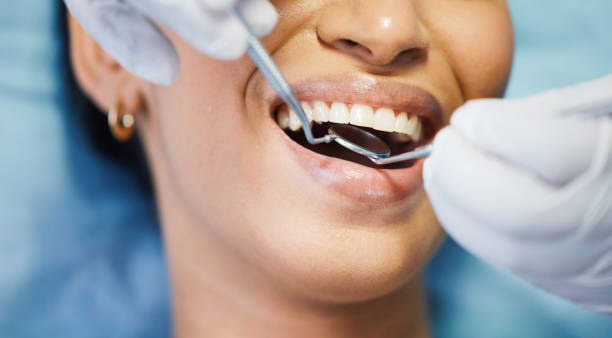 Best Emergency Treatment for Dental Infections or Abscesses in Lake Norman Of Catawba, NC
